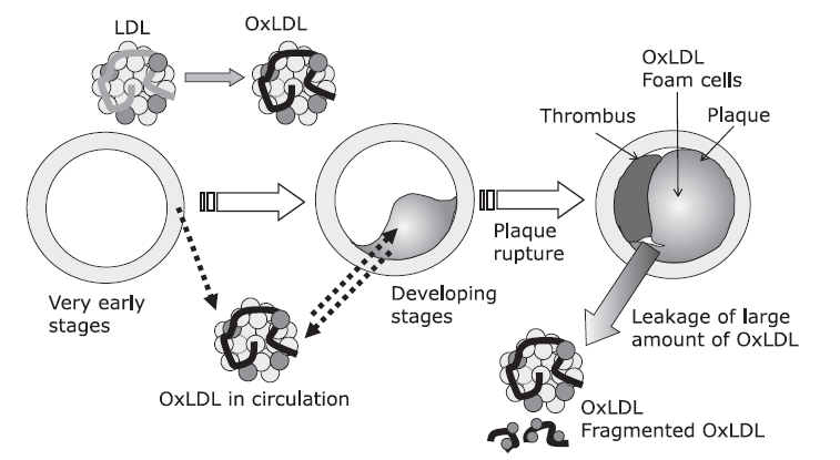 oxldl